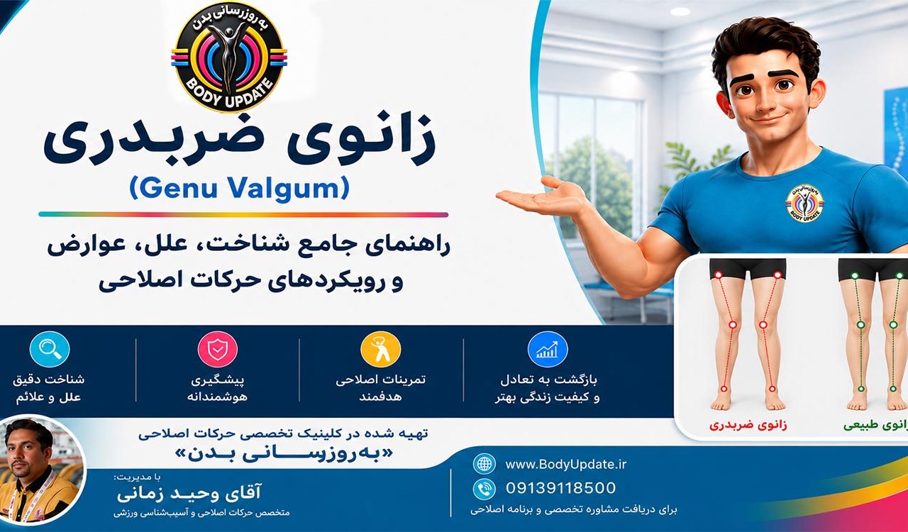 زانوی ضربدری (Genu Valgum): بررسی جامع
